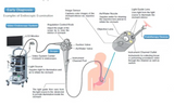 High Quality Disposable Standard Endoscopic Biopsy Valve for Olympus/Fujilm